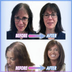 Clip-In Volume Hair Topper for Thinning Hair - Natural Appearance