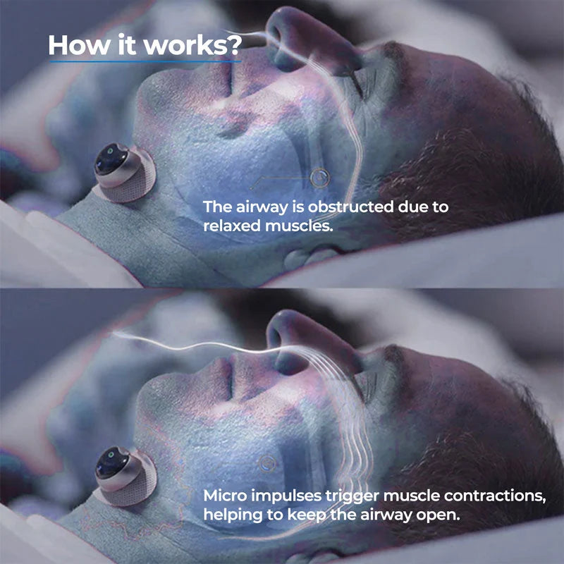 Anti-Snore Chin Clip Adjustable Skin-Friendly