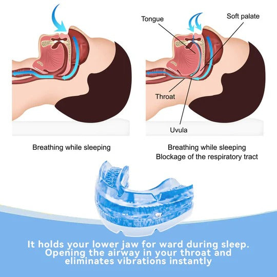 Anti-Snoring Mouth Guard Adjustable Jaw Support Medical-Grade BPA-Free