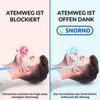 Anti-Snoring Mouthpiece Adjustable Ergonomic Fit
