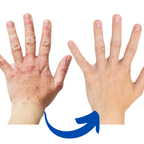 Arthritis Gloves Rechargeable Infrared Therapy Ergonomic & Breathable