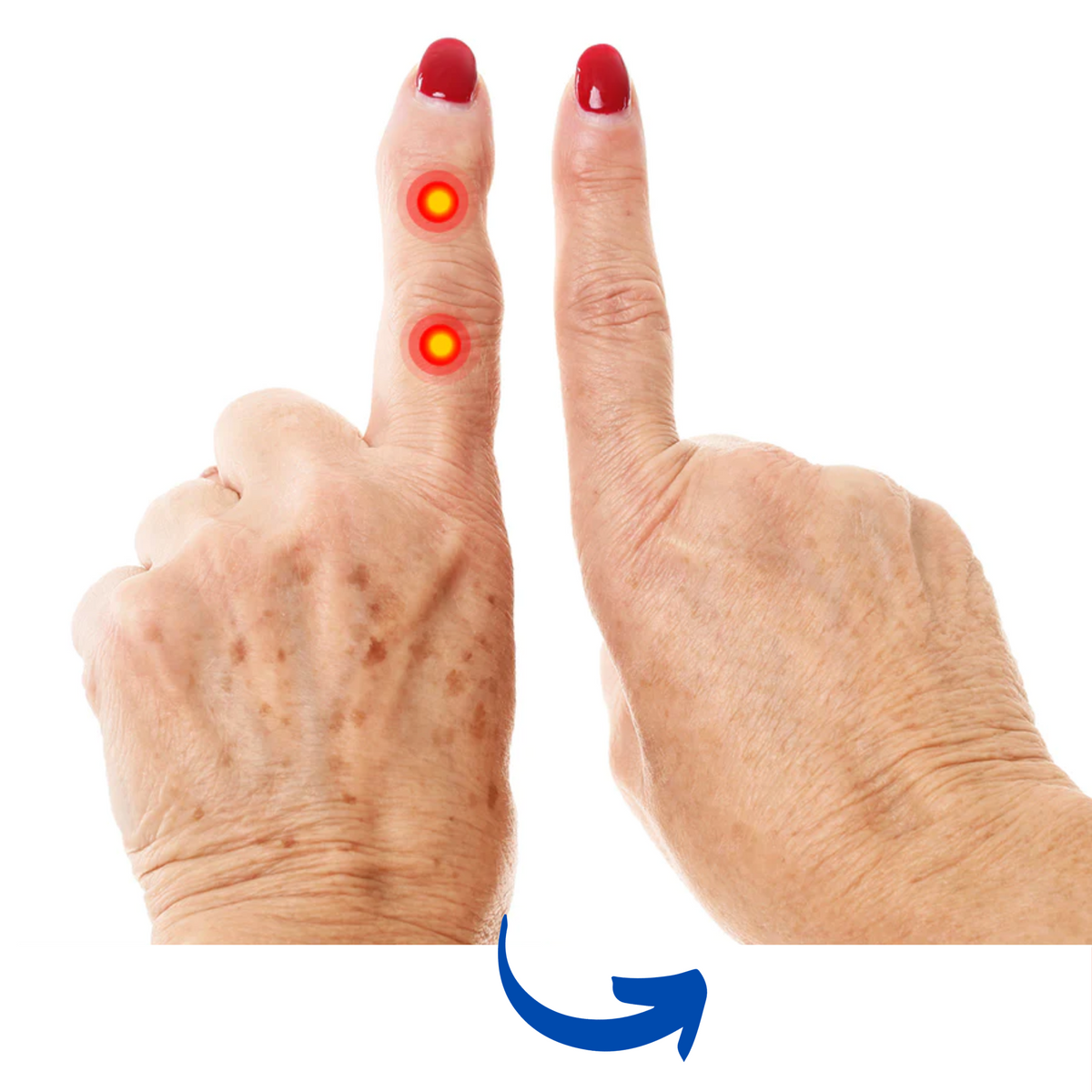 Arthritis Gloves Rechargeable Infrared Therapy Ergonomic & Breathable