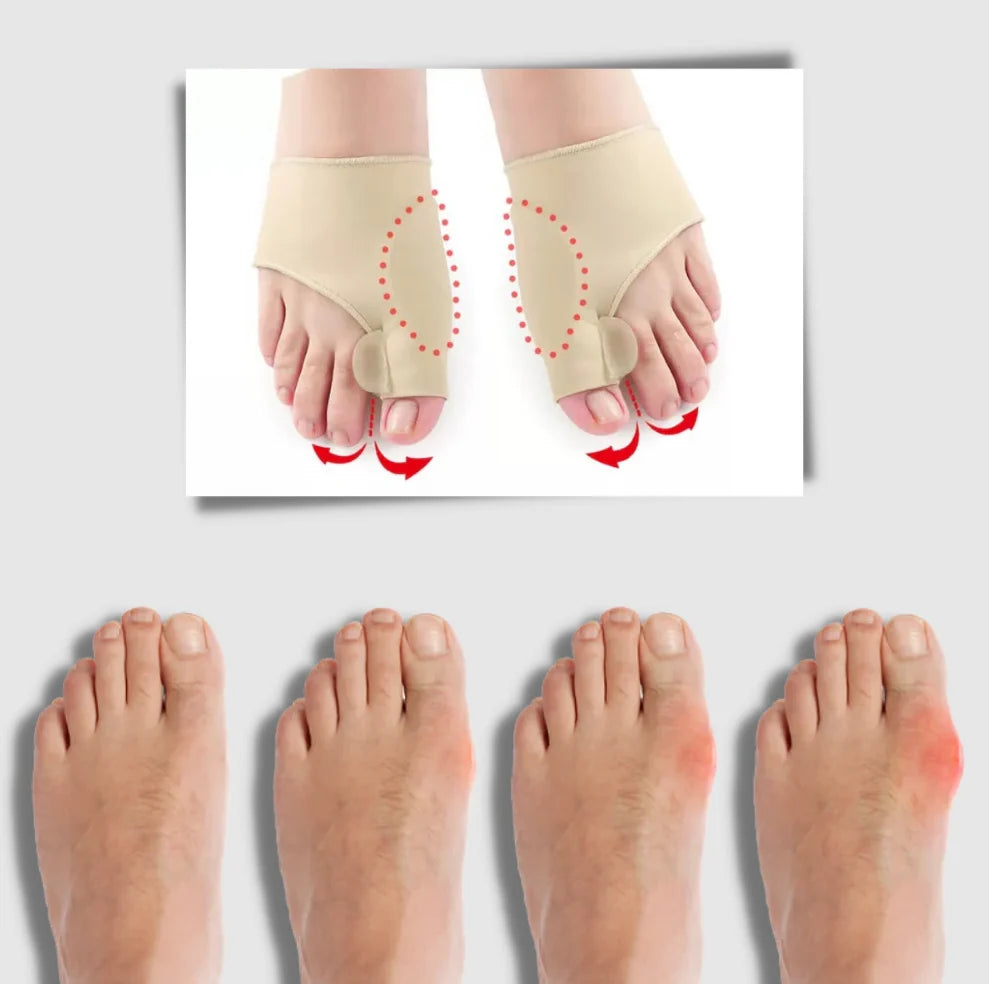 Bunion Corrector Silicone Gel & Breathable Sleeve Set Of 2