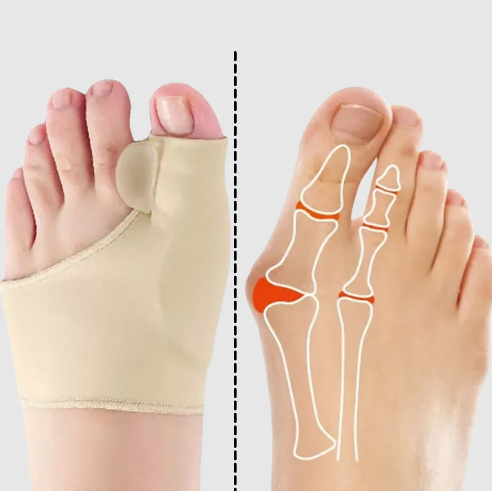 Bunion Corrector Soft Gel Separator & Side Cushion