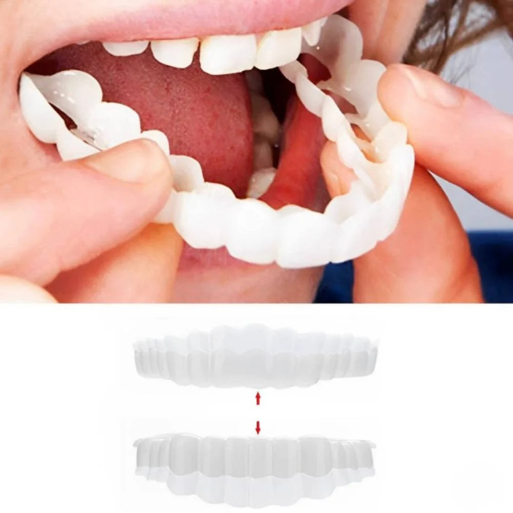 Clip-On Veneers Custom Mold Natural-Looking Upper & Lower