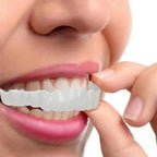 Clip-On Veneers Custom Mold Natural-Looking Upper & Lower