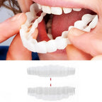 Clip-On Veneers Natural-Looking Upper & Lower