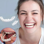 Clip-On Veneers Natural-Looking Upper & Lower