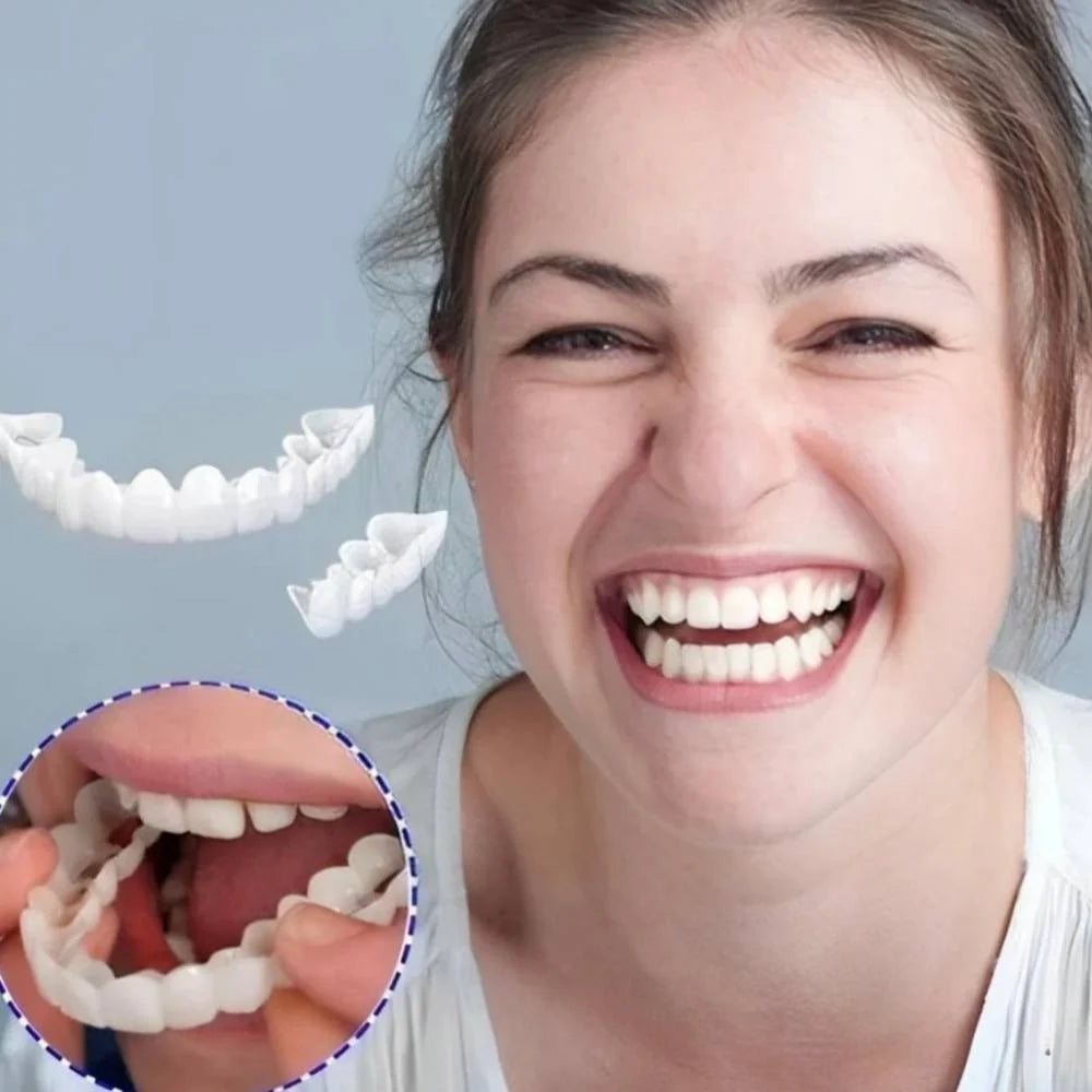 Clip-On Veneers Natural-Looking Upper & Lower