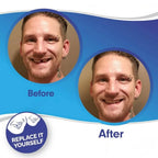 Clip-On Veneers Natural-Looking Upper & Lower