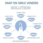 Clip-On Veneers Natural-Looking Upper & Lower