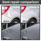 Dent Removal Kit Paint-Safe Steel & Plastic