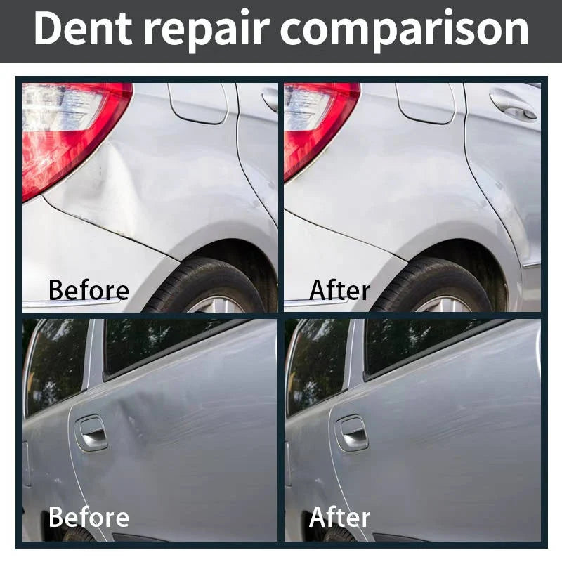 Dent Removal Kit Paint-Safe Steel & Plastic