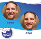 Dental Veneers Set Instant Fit Reusable