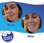 Dental Veneers Set Instant Fit Reusable