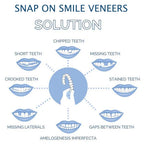 Dental Veneers Set Instant Fit Reusable