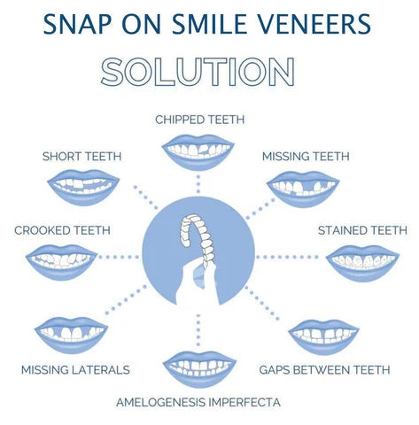 Dental Veneers Set Instant Fit Reusable