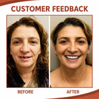 Denture Cushions Soft Silicone Non-Slip Custom Fit
