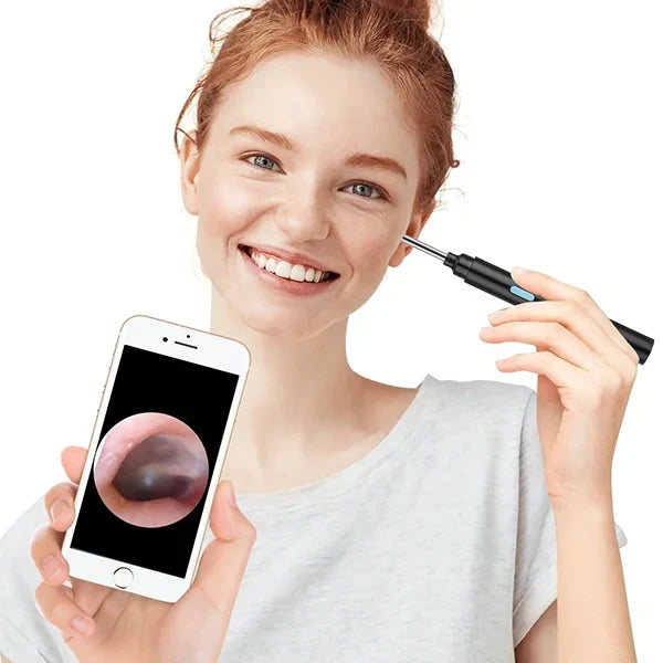 Ear Camera Scope 20x Magnification Anti-Fog Lens & Wireless App