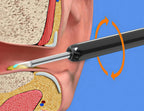 Ear Cleaner HD Camera Silicone Tip & LED