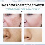 Face Cream Nicotinamide Brightening Lightweight