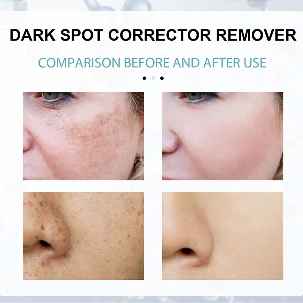 Face Cream Nicotinamide Brightening Lightweight