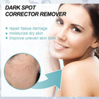 Face Cream Nicotinamide Brightening Lightweight
