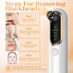 Facial Pore Vacuum Adjustable Suction & USB-C Rechargeable
