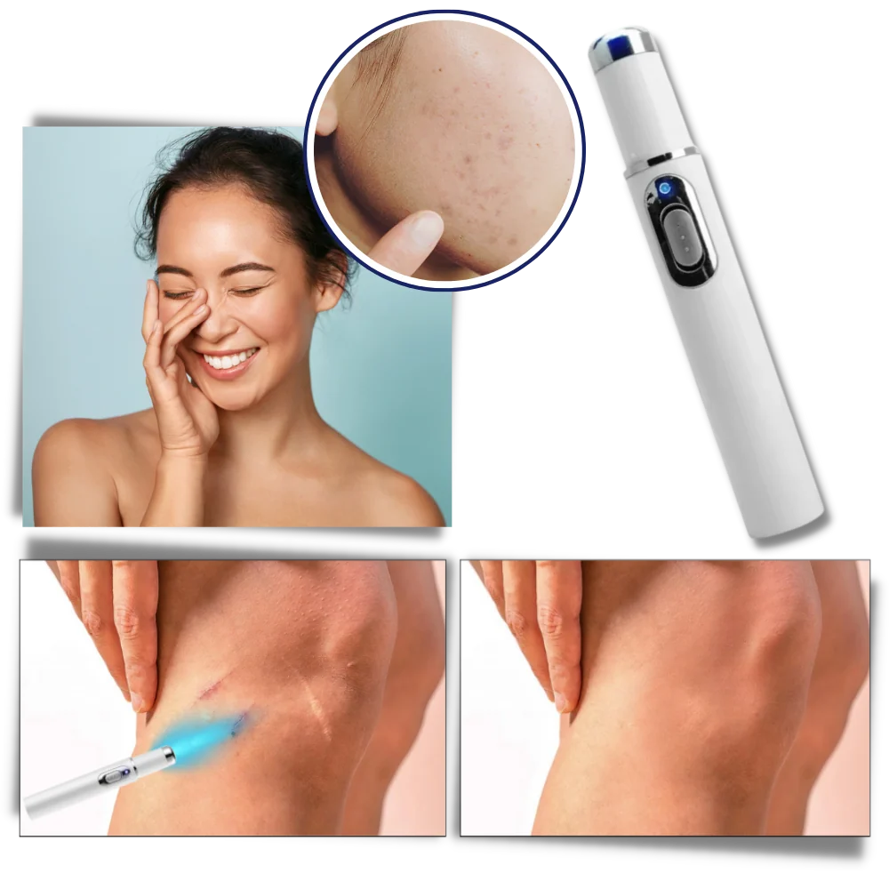 Facial Skincare Pen Blue Light Therapy Precision Applicator