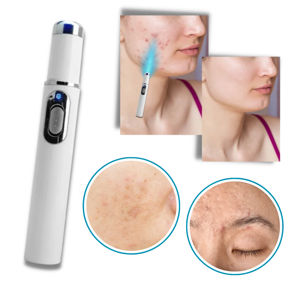 Facial Skincare Pen Blue Light Therapy Precision Applicator