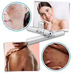 Facial Skincare Pen Blue Light Therapy Precision Applicator