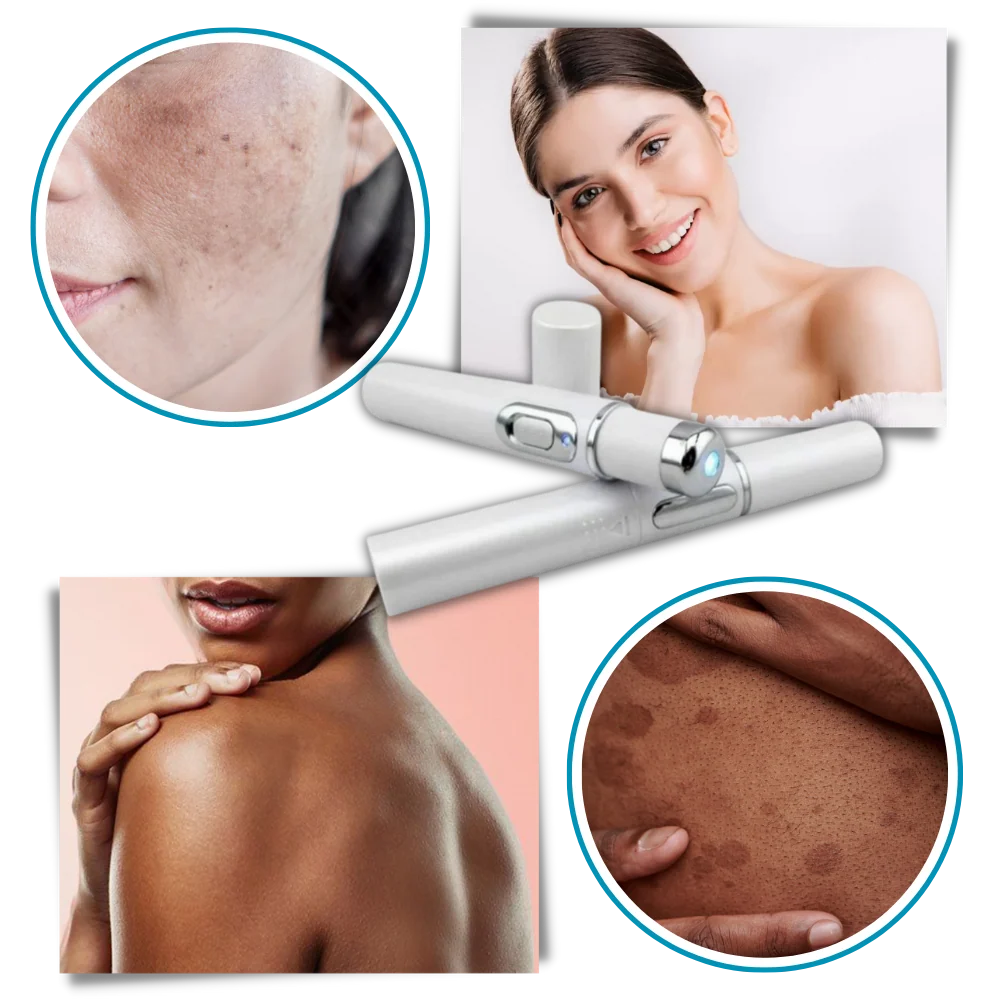 Facial Skincare Pen Blue Light Therapy Precision Applicator