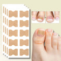 Ingrown Toenail Patches Peel-And-Stick Elastic Fabric Pack Of 20