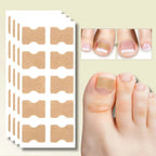 Ingrown Toenail Patches Peel-And-Stick Elastic Fabric Pack Of 20