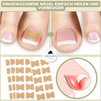 Ingrown Toenail Patches Peel-And-Stick Elastic Fabric Pack Of 20
