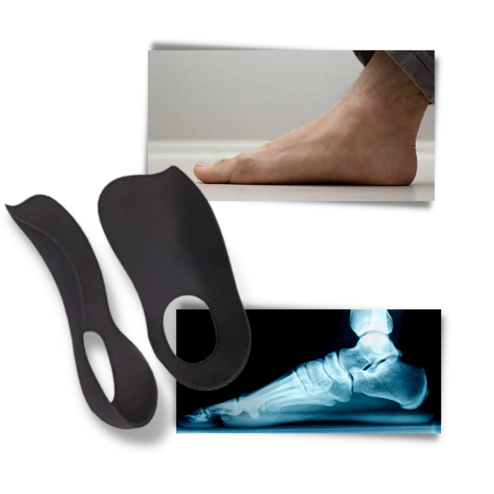 Insoles Anatomical Arch Support Four-Zone Shock-Absorbing