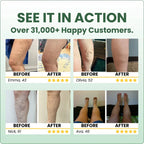 Leg Cream Diclofenac & Horse Chestnut Fast Absorbing Non-Greasy