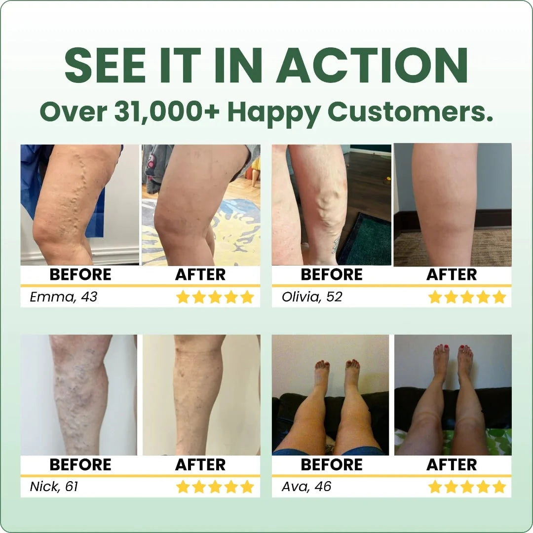 Leg Cream Diclofenac & Horse Chestnut Fast Absorbing Non-Greasy