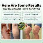 Leg Cream Diclofenac & Horse Chestnut Fast Absorbing Non-Greasy