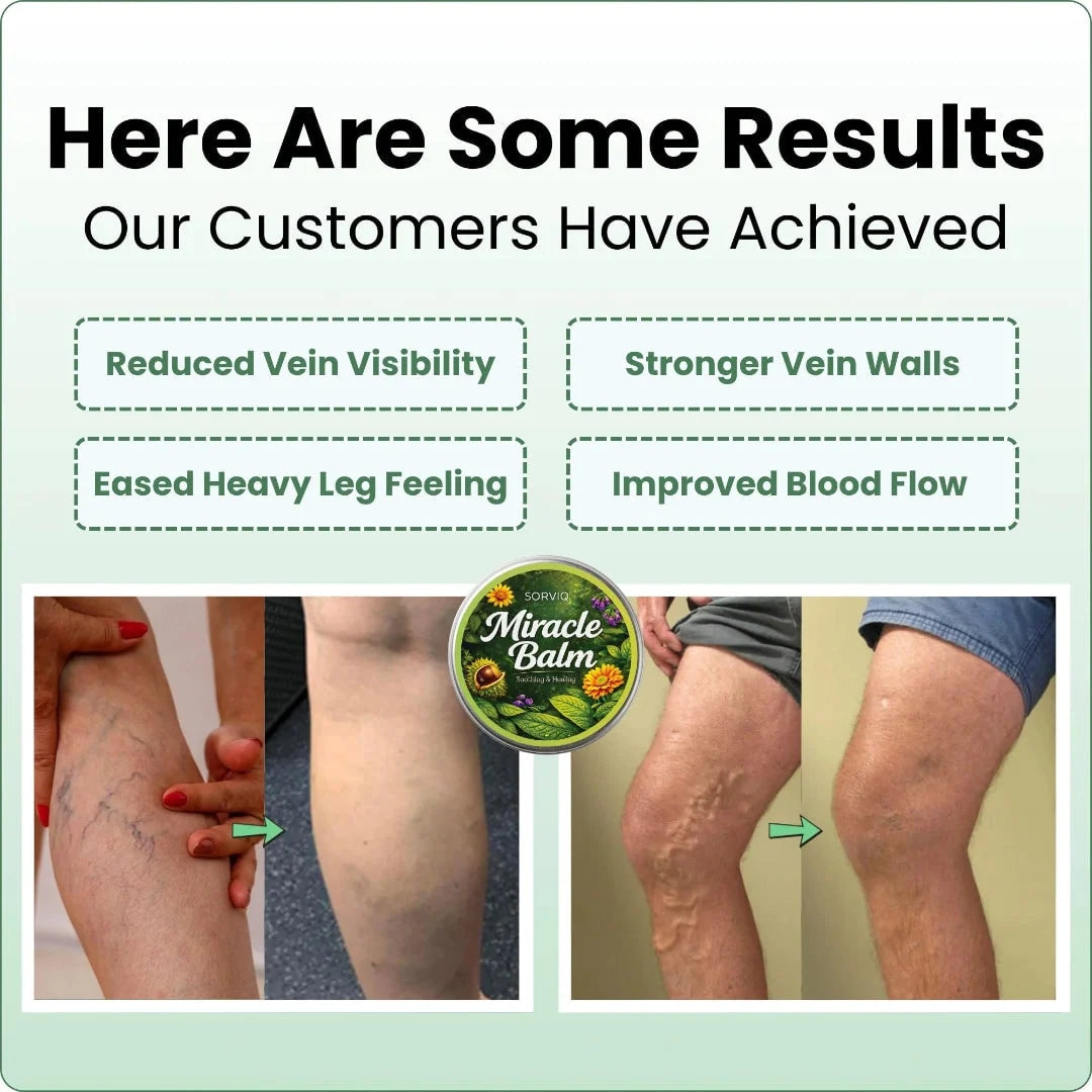 Leg Cream Diclofenac & Horse Chestnut Fast Absorbing Non-Greasy