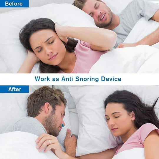 Micro-CPAP Device Compact Noise-Cancelling Comfortable Nasal Seal