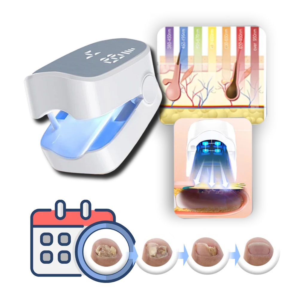 Nail Fungus Laser Device Dual Cold & Pulse Mode