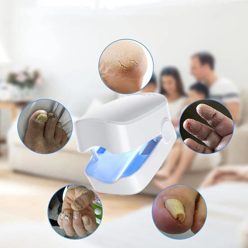 Nail Fungus Light Therapy Device USB Rechargeable 910nm