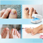Nail Fungus Light Therapy Device USB Rechargeable 910nm