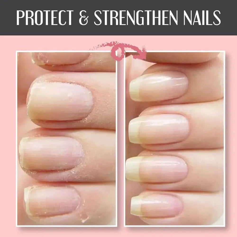 Nail Repair Gel Strengthening Hypoallergenic Air-Dry