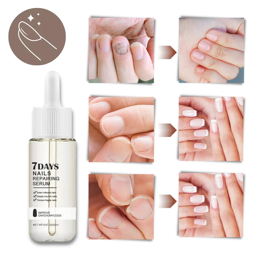 Nail Repair Serum Brush Tip Glycerin Moisture-Lock