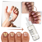 Nail Repair Serum Brush Tip Glycerin Moisture-Lock