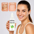 Nail Treatment Herbal Repair & Strengthening Antibacterial