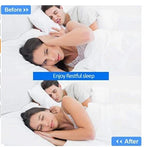 Nasal Dilator Medical-Grade Silicone Reduces Snoring