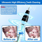 Pet Tooth Cleaner Ultrasonic Rechargeable Tartar & Plaque Removal